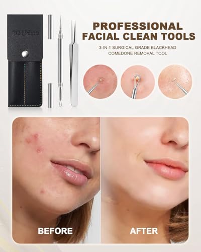 Professional Facial Milia & Blackhead Removal Tool Kit
