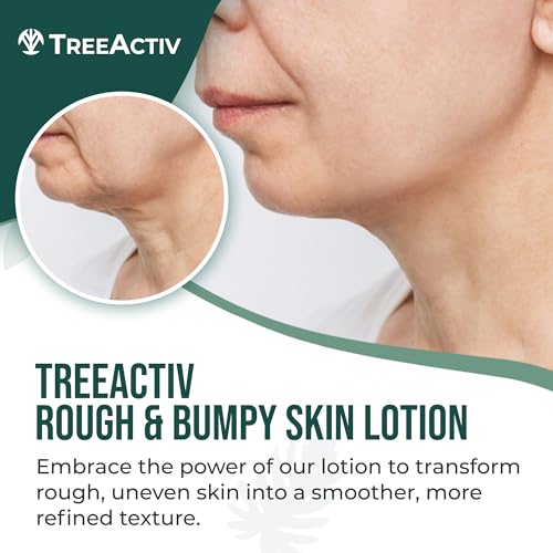 TreeActiv Rough and Bumpy Skin Lotion, 8 fl oz, With Hyaluronic Acid, Shea Butter and Vitamin E, Nourishing Lotion for Rough and Bumpy Skin, Moisturizing Strawberry Legs, For All Skin Types