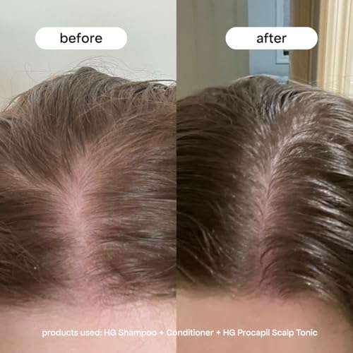 BONDIBOOST Procapil Scalp Treatment Serum for Thicker Hair