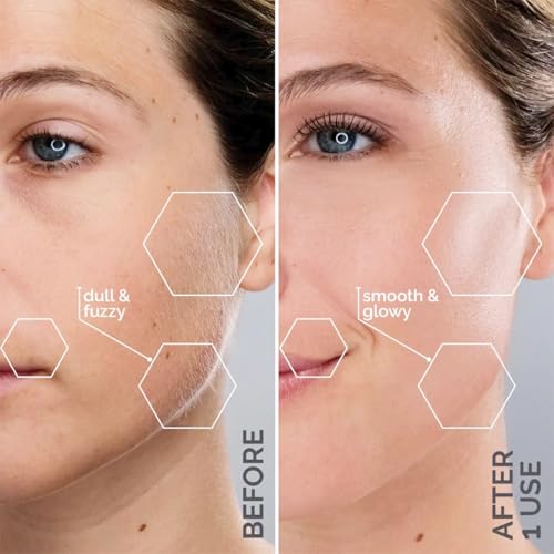 Michael Todd Sonicsmooth Dermaplaning Tool | Sonic Facial Hair Remover