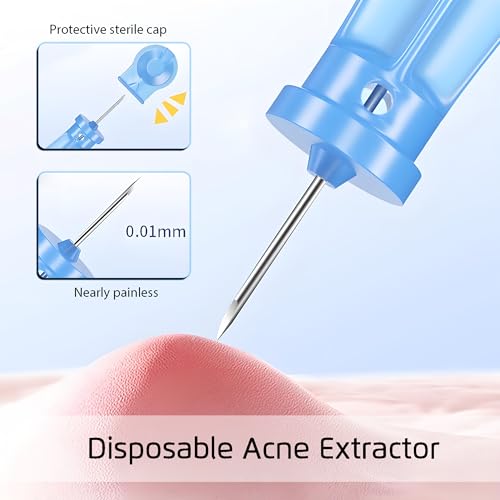 8PCS Blackhead Remover Kit - Pimple Extractor Tools for Face, Stainless Steel