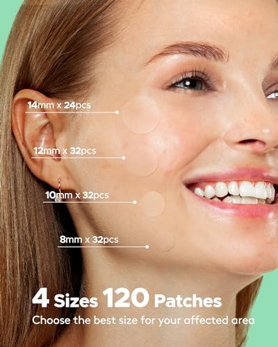 TKTK Pimple Patches for Face, 4 Sizes Acne Patches Hydrocolloid Zit Patches Acne Dots Cystic Pimple Stickers Acne Cover Patch with Tea Tree and Calendula Oil