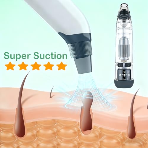 Blackhead Remover Pore Vacuum with Hot Compress, 69KPa Suction