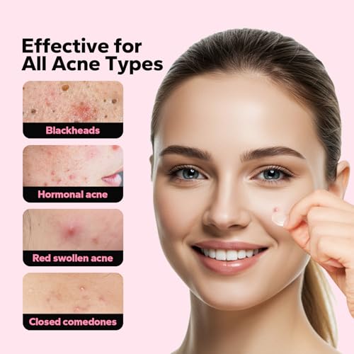 Pimple Patches for Face (18 Count), Microdart Acne Patches, Hydrocolloid Blemish Spot with Salicylic Acid, Fast-Acting for Early Stage Deep Pimples, Zits, Breakouts & Cystic Acne