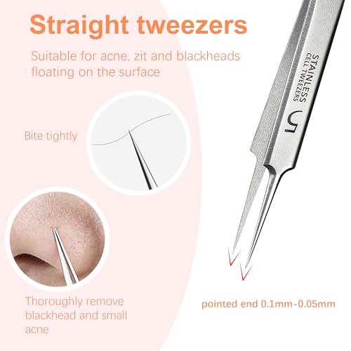 Blackhead Remover Tweezers Kit - 3-Piece Acne Extractor Tool Set