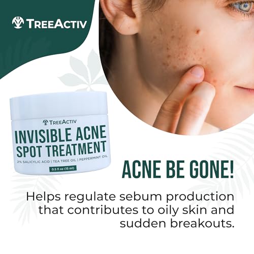 TreeActiv Invisible Salicylic Acid Spot Cream, Original Formula Lightweight Face & Body Cream for Acne-Prone Skin, Daily Use for Teens & Adults, Clear-Drying, Gentle Formula, 0.5 fl oz