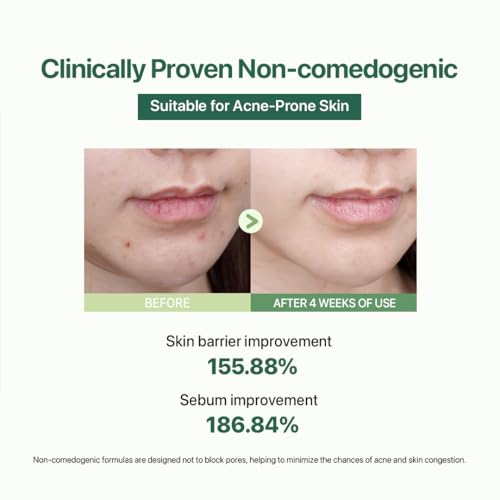 Le Nubele Azulene CICA Skin Toner for Clear Skin, Azulene 600ppm, Centella Asiatica 5000ppm, Hydrating, Non-Comedogenic, Calming, Redness Relief, Fungal Acne Safe, Korean Skin Care, 120ml/4.05 fl.oz.