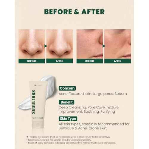 K-SECRET SEOUL 1988 Cica Cleansing Foam ? Deep Pore Cleansing & Soothing Care | Daily Facial Cleanser for Sensitive Skin | Korean Skincare, 150ml / 5.07 fl oz