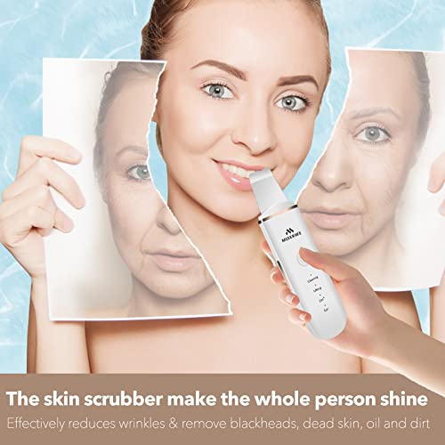 MISERWE Face Skin Scrubber - Deep Cleansing Spatula with 4 Modes