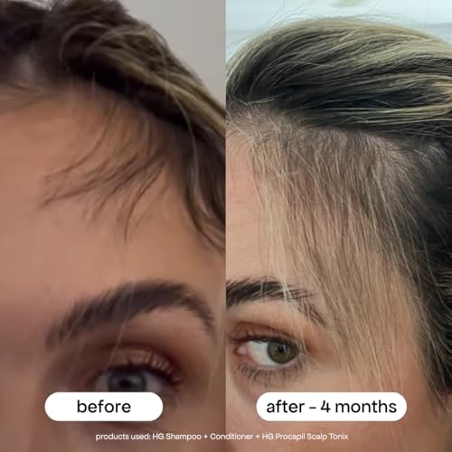 BONDIBOOST Procapil Scalp Treatment Serum for Thicker Hair