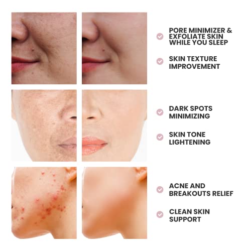 SKIN DEVA Glycolic Acid Night Cream, Exfoliating Face Cream with Kojic Acid, Niacinamide & Retinol, Helps Improve Skin Texture, Brighten Appearance & Minimize the Look of Pores ? 2 oz