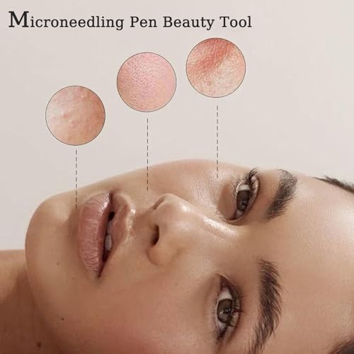 Derma Roller Pen 0.25mm, Microneedling Pen Beauty Tool for Hair Face Scalp Beard Skin Care At Home Use