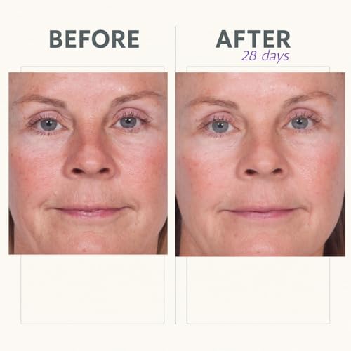 Reverse Lift Firming Serum for Face & Neck - Anti-Aging Peptides