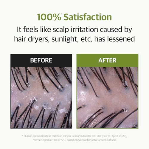 RYO ROOT:GEN Scalp Serum for Hair Loss & Thinning Hair