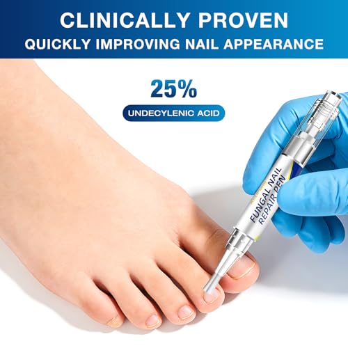 AntiFung Toenail Fungus Treatment Pen - 25% Undecylenic Acid