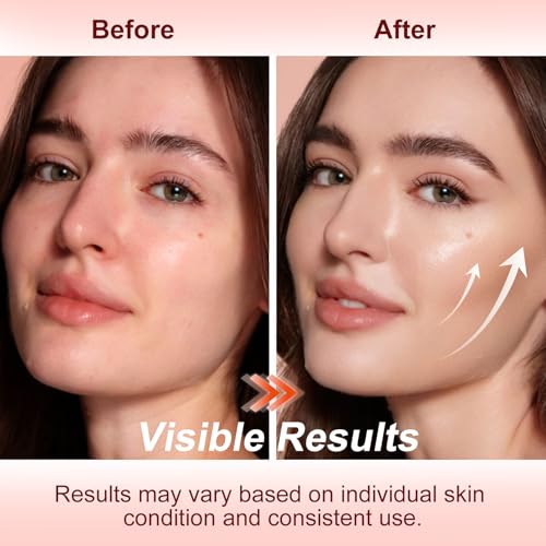Face Lifting Facial Massager, Face Massager Tool with Suction, 7 Colors Red Light Therapy Face Lift Device for Skin Tightening Wrinkle & Lifting