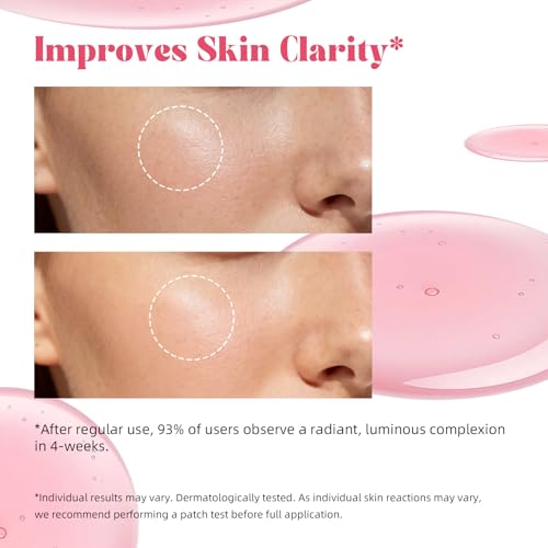 ANRCOLLECT Tranexamic Acid Serum with 5% Txa & 10% Niacinamide, Kojic Acid, Niacinamide Acido Tranex?mico Perfect Serum with Hyaluronic Acid, Ceramides, 1 OZ / 30ML, Valentines Day Gifts