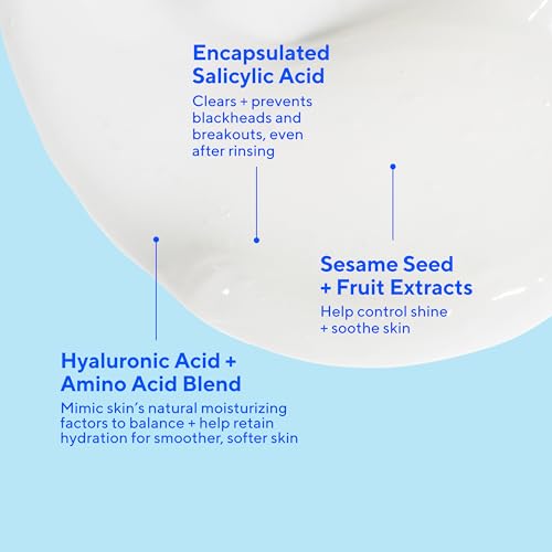 Murad Clarifying Cream Cleanser ? Gentle Salicylic Acid Face Wash for Acne-Prone and Sensitive Skin, Treats and Prevents Breakouts and Calms Irritation with Extra Hydration
