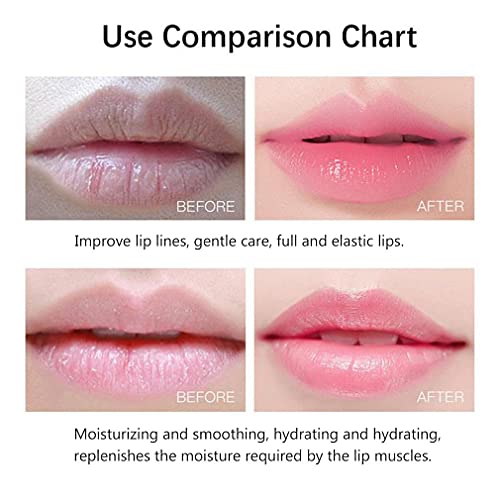 20Pcs Moisturizing/Plumping Lip Mask, Restores Moisture Mask for Dry Lips and Lines Overnight Care, Gel Treatment Masks ? (Pink)
