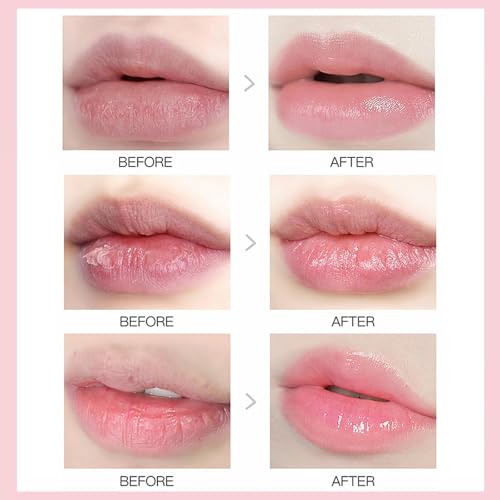 9 PCS Bee Lip Balm Lip Mask Honey Pot, Galentines & Valentines Day Gifts, Nourishing Hydrating Propolis Lip Balm for Dry, Chapped & Cracked Lips,Lip Sleeping Mask - Soften,Smooth & Reduce Lip Lines