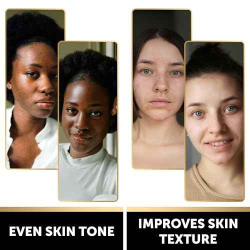 VALITIC Charcoal Kojic Acid Turmeric Black Soap Bar Dark Spot Remover for Body or Face Wash - 2 Pack and African Net Sponge