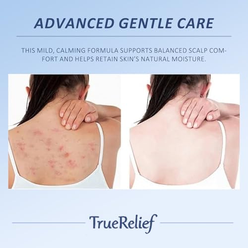 Folliculitis Relief Cream - Gentle Post-Shave Moisturizer for Men & Women - 4.23 oz