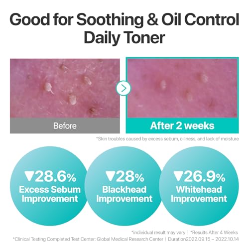 numbuzin No.1 Toner | Pure-Full Calming Herb Toner | Breakouts, Redness, Excess Oil Control | Centella Asiatica, Heartleaf, Licorice Root | Acne-Prone, Sensitive Skin | 10.14 fl. oz.