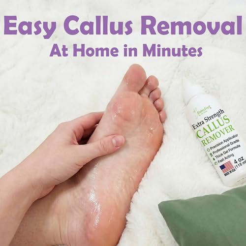 Extra Strength Foot Callus Remover Gel - 4oz Professional Formula for Softening Dead Skin