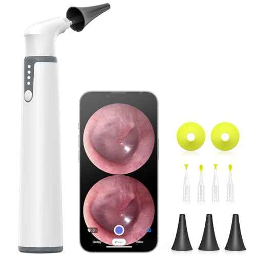 Wireless Otoscope with Gyroscope, Ear Camera with Dual View, 3.9 mm Otoscope with Light, Ear Scope with Ear Wax Removal Tool for Kids, Adults, and Pets, Compatible with iPhone and Android
