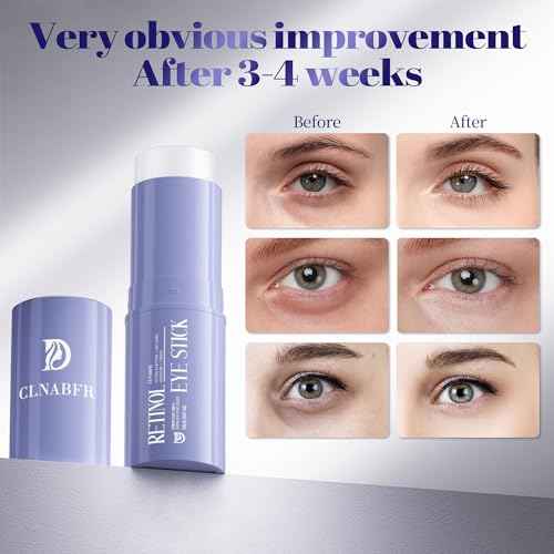 Retinol & Caffeine Eye Balm Stick for Dark Circles, Puffiness, Fine Lines and Eye Bags, Anti Aging Under Eye Cream Smooths Wrinkles Moisture Stick (0.24oz/7g)