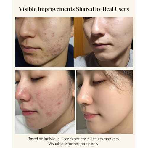 Centella Asiatica Serum Korean - Redness Corrector for Face - 38% Cica Leaf Water and Madecassoside - Ph Balanced - Barrier Support - Lightweight Calming - Rosacea Skincare Serum - Centella Ampoule