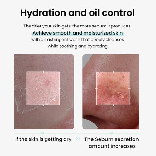ilso Super Melting Sebum Cleansing Oil - Makeup & Blackhead Remover