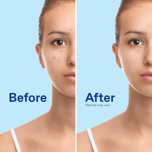 Differin Maximum Strength Acne Foaming Face Wash 10% Benzoyl Peroxide 5oz