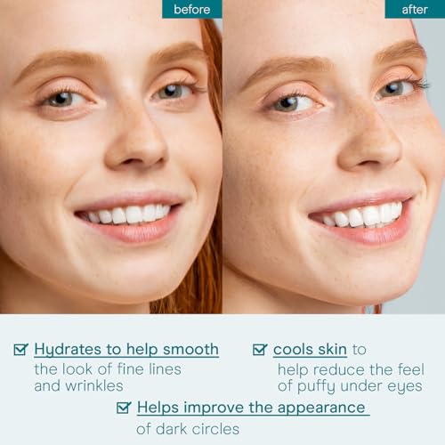 Baebody Cooling Under-Eye Gel for Dark Circles & Puffiness 1.7oz