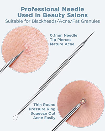 Blackhead Remover Tool Kit, 5-Piece Pimple Extractor Set