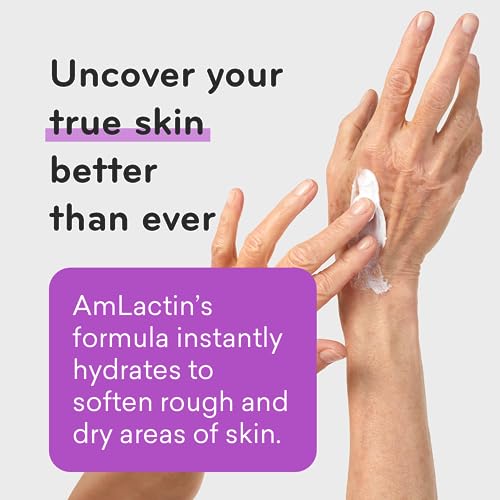 AmLactin Ultra Smoothing - Therapeutic Hand Cream for Dry Cracked Hands - No-Scrub Exfoliator and Moisturizer with 15% Lactic Acid AHA, 4.9 oz (Packaging May Vary)?