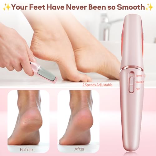 ZABOUL Electric Foot Callus Remover - Rechargeable Electronic Foot File
