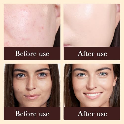 9-in-1 BB Cream with SPF 50 Sunscreen, Full Coverage Foundation