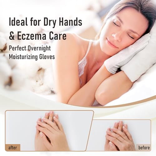 Cotton Gloves 100% for Dry Hands & Eczema Relief 6 Pairs