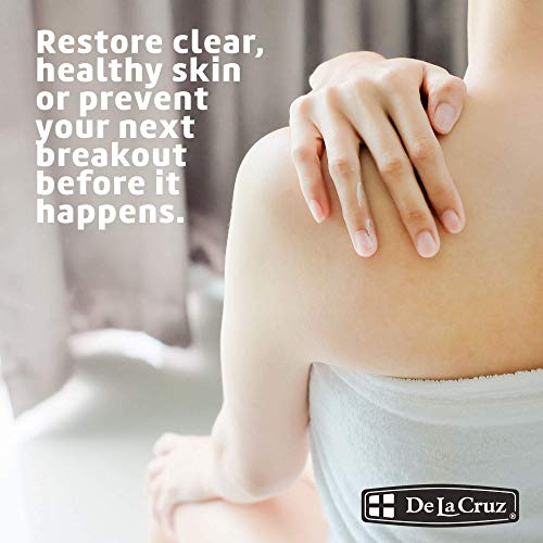De La Cruz 5% Sulfur Ointment - Cystic Acne Treatment for Face and Body - Daily 10 Min Spot Treatment Mask - Safe and Effective Game Changing Hormonal Acne Treatment that Clears Up Pimples 2.6oz Tube