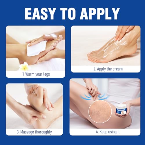 Varicose Veins Cream for Legs - Spider Veins Treatment, 3.4 Oz