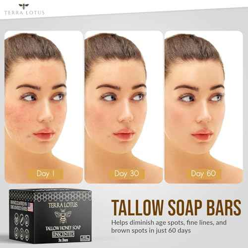 Organic Tallow Soap with Organic Castor Oil & Raw Honey - Relief for Dark Spots, Acne Marks, Hydrating & Nourishing - 3 Pack (Unscented)