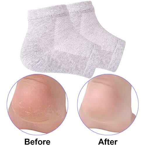 Exptolii Moisturizing Gel Heel Socks - 3 Pairs Toeless Spa