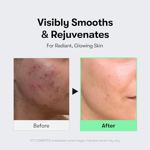 VT CICA Reedle Shot 100 Microneedling Serum 50ml
