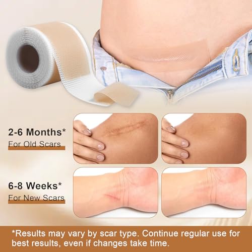 Silicone Scar Sheets for C-Section & Surgery - 3M Roll (1.6"x118") - Reusable & Hypoallergenic Scar Tape to Fade Scars from Acne, Burns, Keloid | Doctor Recommended