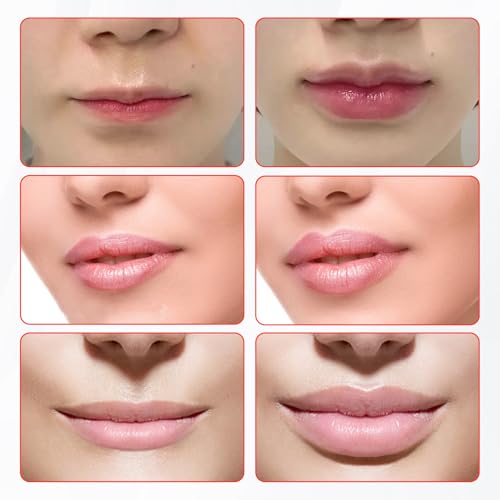 Lip Plumper Device - Fuller Lips Enhancement Tool