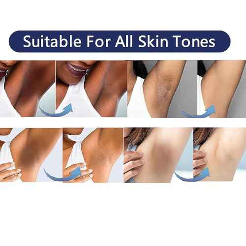 Intimate Areas Skin Lightening Cream for Private Parts, Underarm, Intimate Area, Bikini Area, Inner Thighs, Knees, Elbows, Bleach Skin Bleaching Whitening Cream For Body