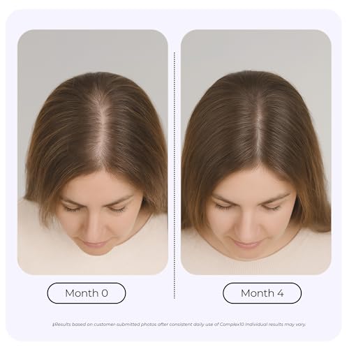 GROWPLEX Complex10 Hair Support Supplement – Biotin & Collagen, 30 Capsules