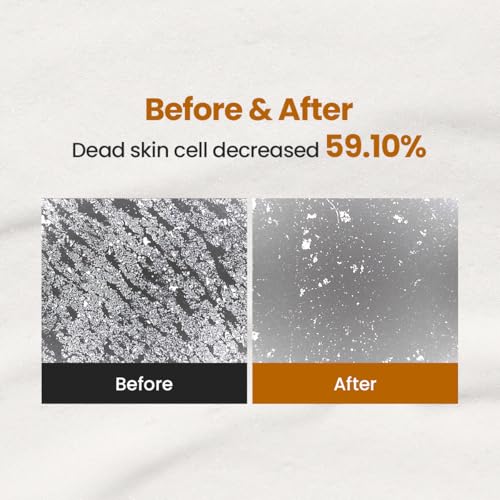 Enzyme Cleansing Powder ? 40g (1.41 oz) ? Purifies Pores, Removes Blackheads & Whiteheads, With Papain Enzyme for Smooth & Clear Skin | Low pH, Non-Irritating, For Sensitive Skin