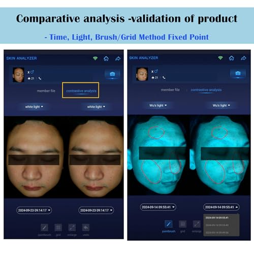 Professional Skin Analysis Device 15.6" – AI 7-Spectral Imaging for Salons